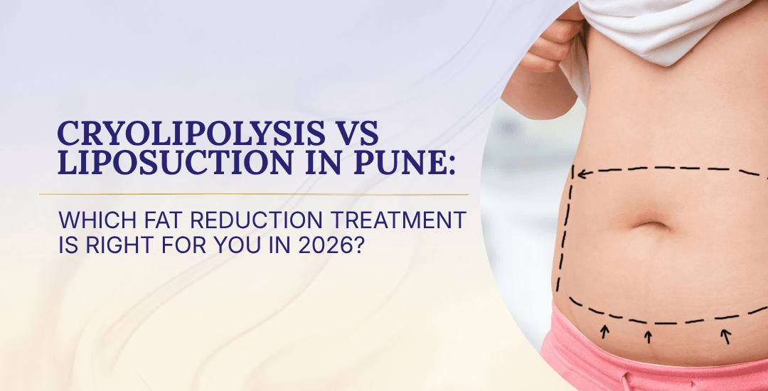 Cryolipolysis vs Liposuction in Pune