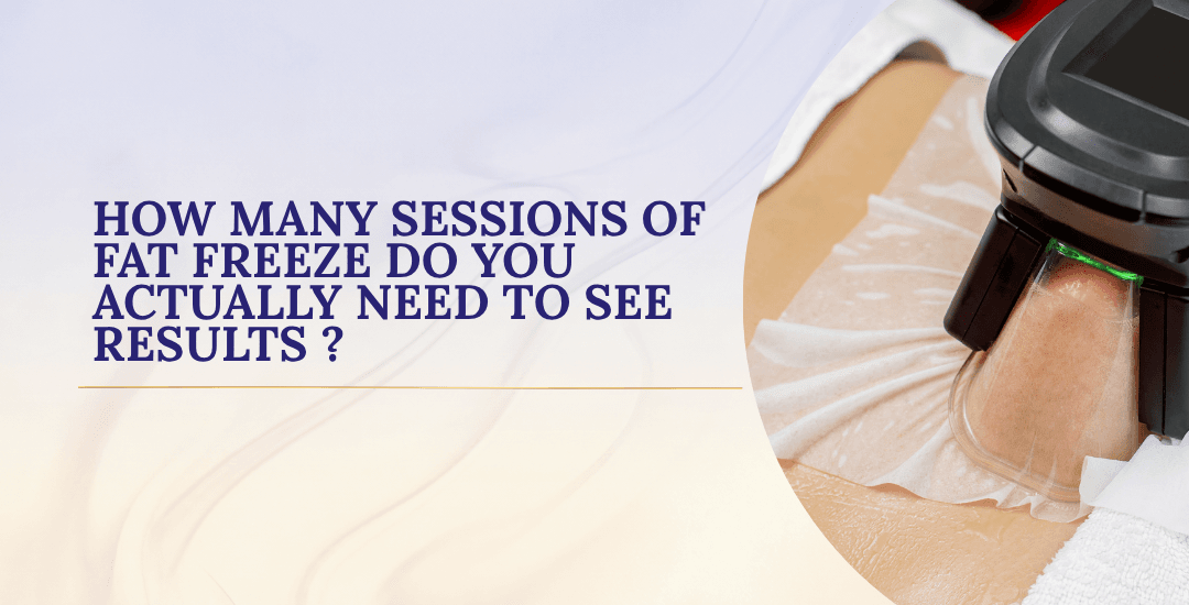 How Many Sessions of Fat Freeze Do You Actually Need to See Results