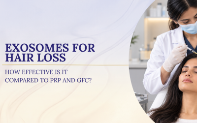 Exosomes For Hair Loss: How Effective Is It Compared To PRP And GFC?